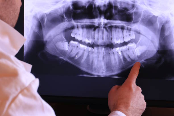Best Emergency Dental Extractions in South Zanesville, OH